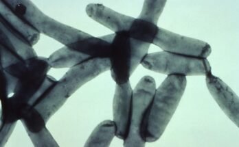 Qu'est-ce que la maladie du légionnaire? Voici ce qu'il faut savoir des épidémies de New York