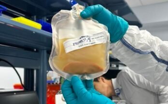 Cette start-up vise à cultiver de nouveaux mini-algans chez les patients