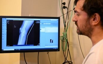 Les outils d'IA peuvent nuire aux compétences des médecins
