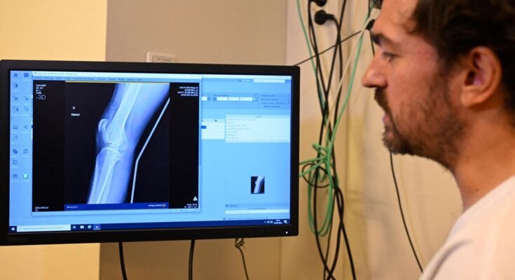 Les outils d'IA peuvent nuire aux compétences des médecins