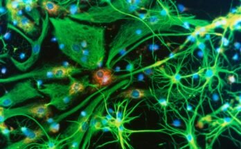 Microcroat lumineux immunofluorescent de cellules cérébrales vertes à portée de laisse contenant des points bleus et rouges sur fond noir